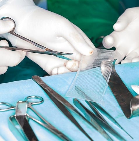 Meshes For Hernia surgeon chops mesh for hernia
